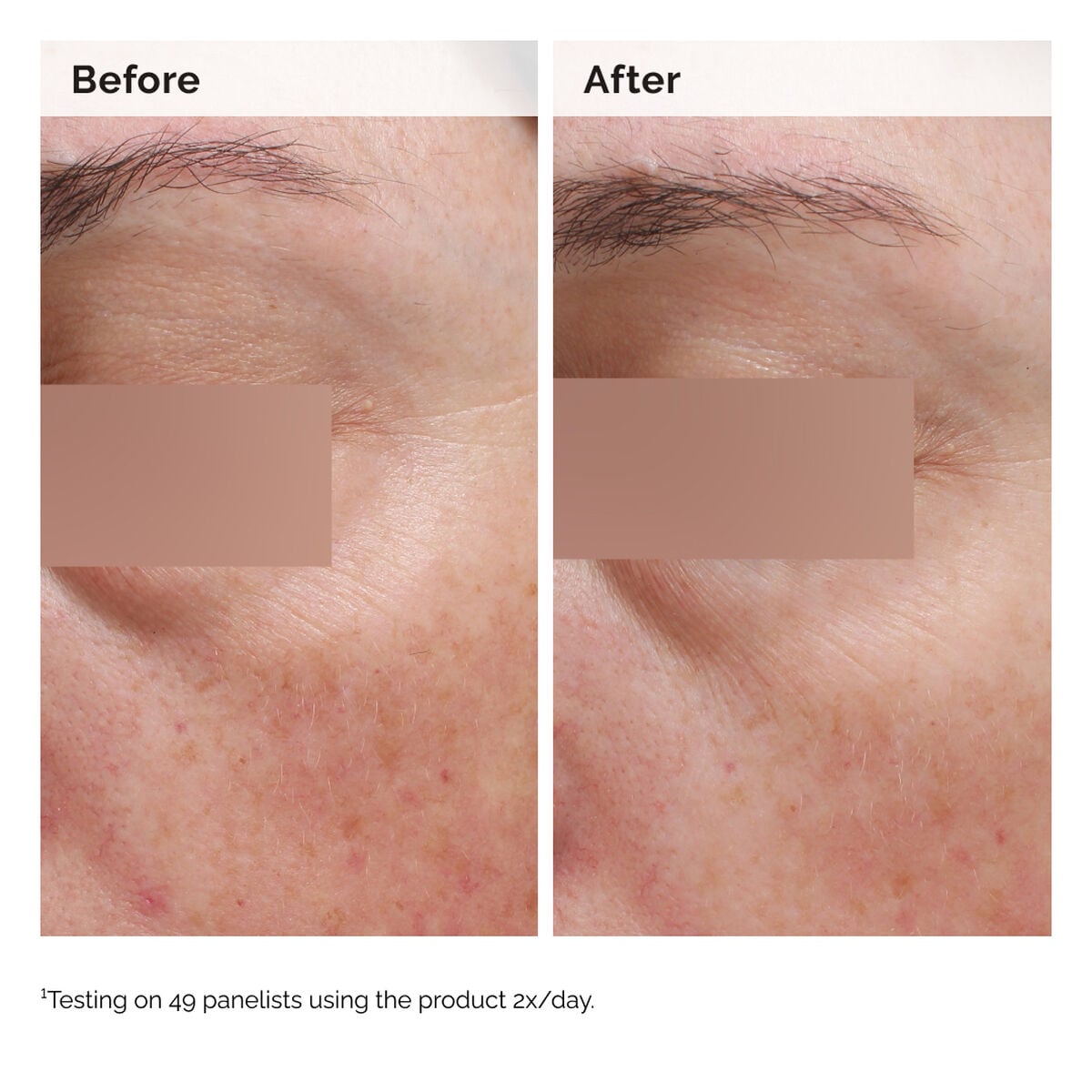 niacinamide-5-face-and-body-emulsion-y0 2024-08-23-ORD-Nia-5pct-Face-Body-B-A-Elasticity-Global-02-1x1.jpg