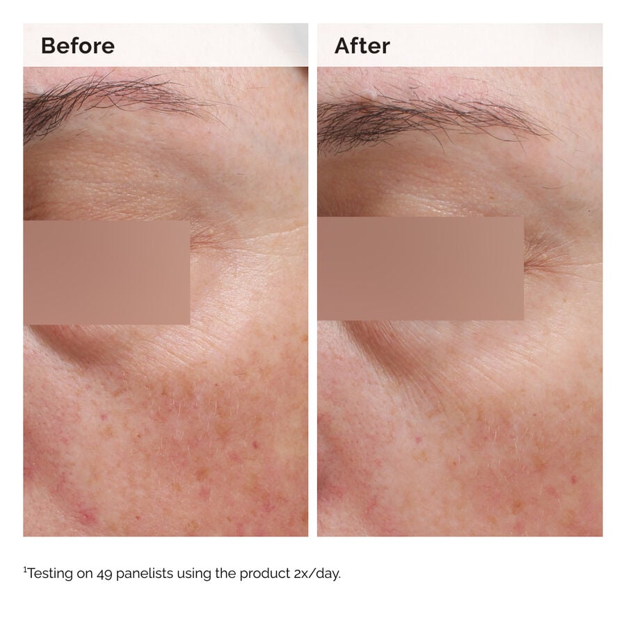niacinamide-5-face-and-body-emulsion-y0 2024-08-23-ORD-Nia-5pct-Face-Body-B-A-Elasticity-Global-02-1x1.jpg
