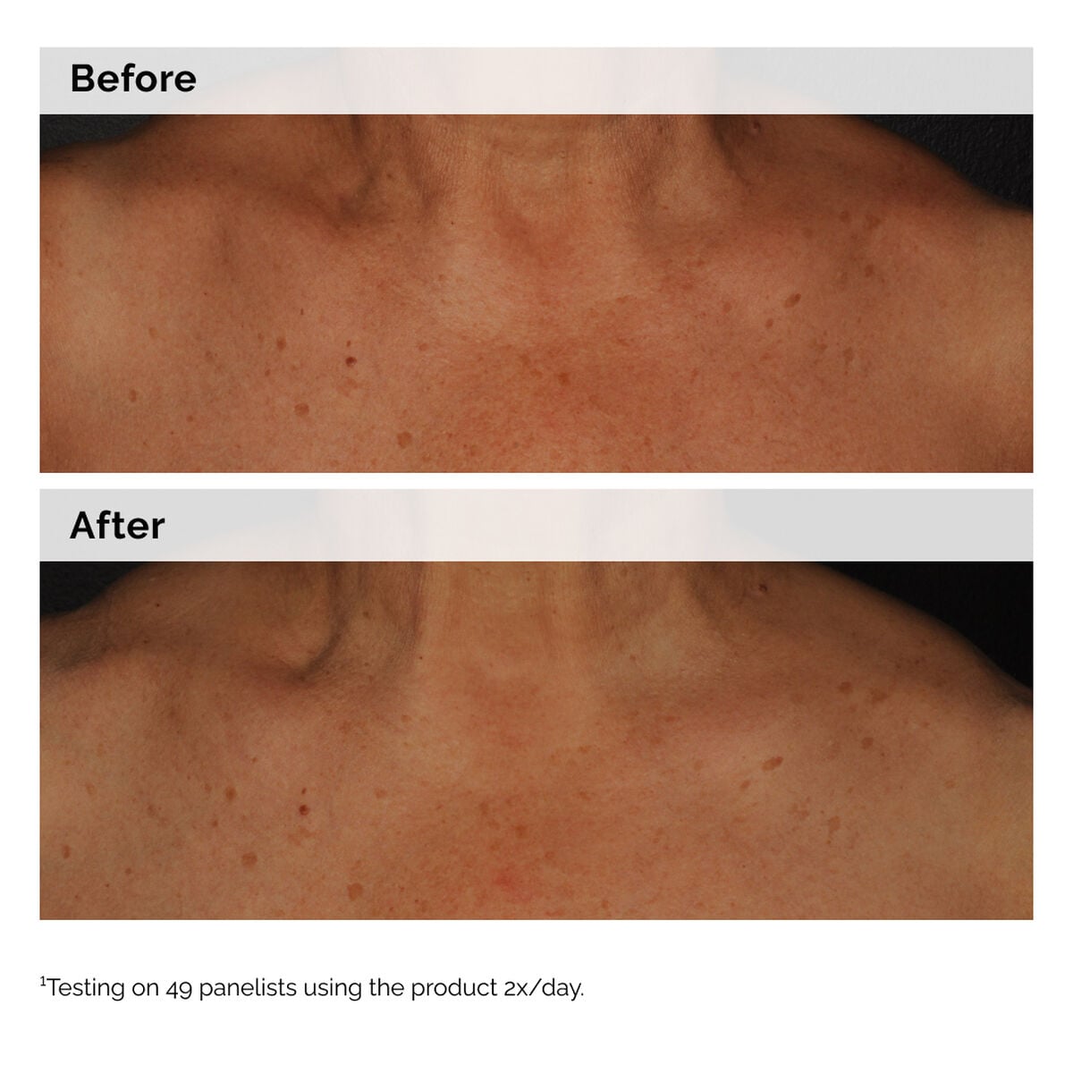 niacinamide-5-face-and-body-emulsion-y0 2024-08-23-ORD-Nia-5pct-Face-Body-B-A-Global-02-1x1.jpg