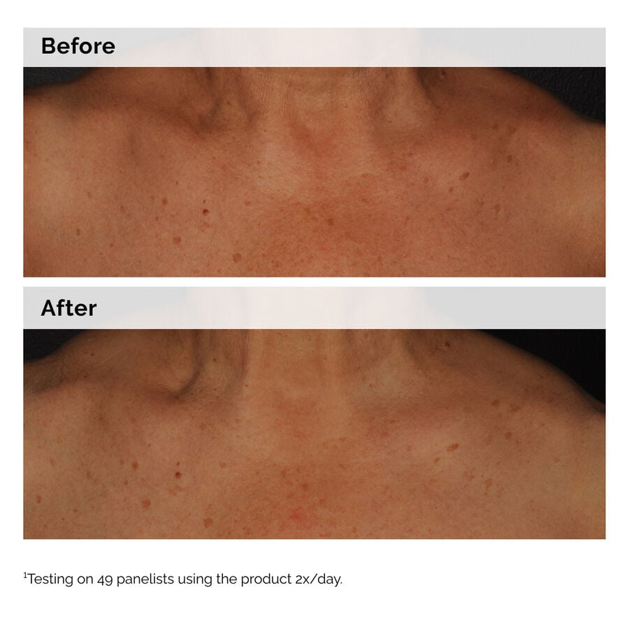 niacinamide-5-face-and-body-emulsion-y0 2024-08-23-ORD-Nia-5pct-Face-Body-B-A-Global-02-1x1.jpg