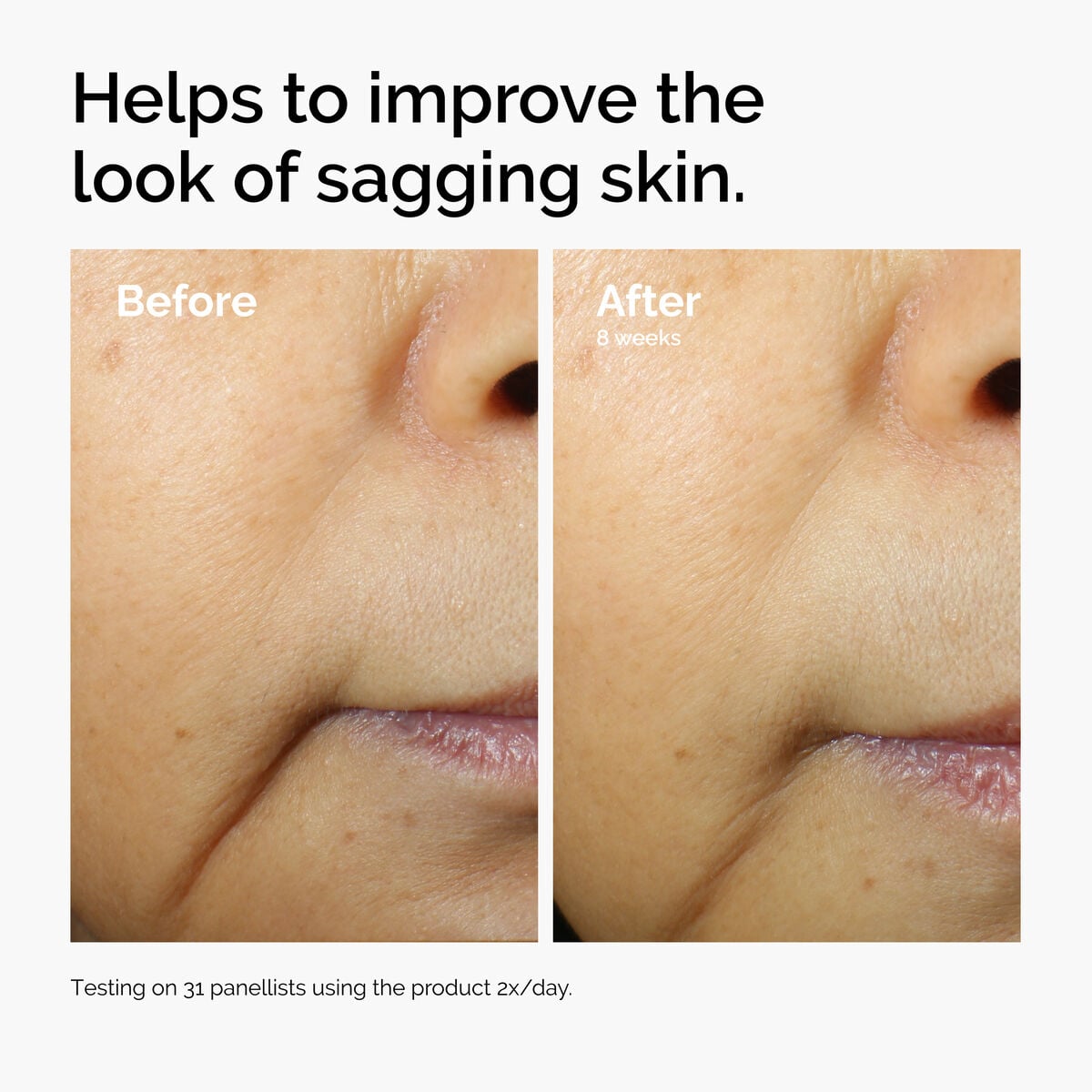 caffeine-3-escin-1-face-serum-y3 ord-caffeine-3pct-escin-1pct-face-serum-before-after-sagging.jpg
