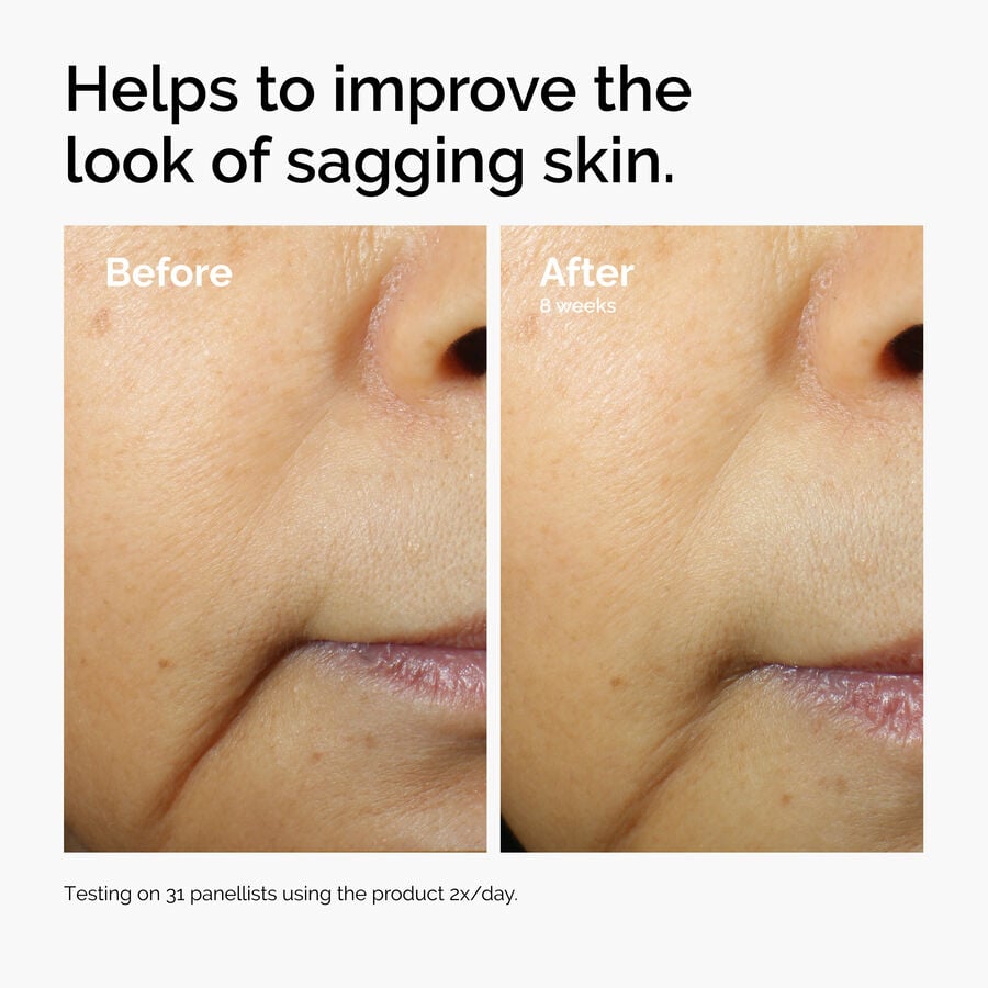 caffeine-3-escin-1-face-serum-y3 ord-caffeine-3pct-escin-1pct-face-serum-before-after-sagging.jpg