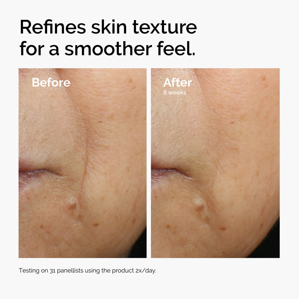 caffeine-3-escin-1-face-serum-y3 ord-caffeine-3pct-escin-1pct-face-serum-before-after-texture.jpg