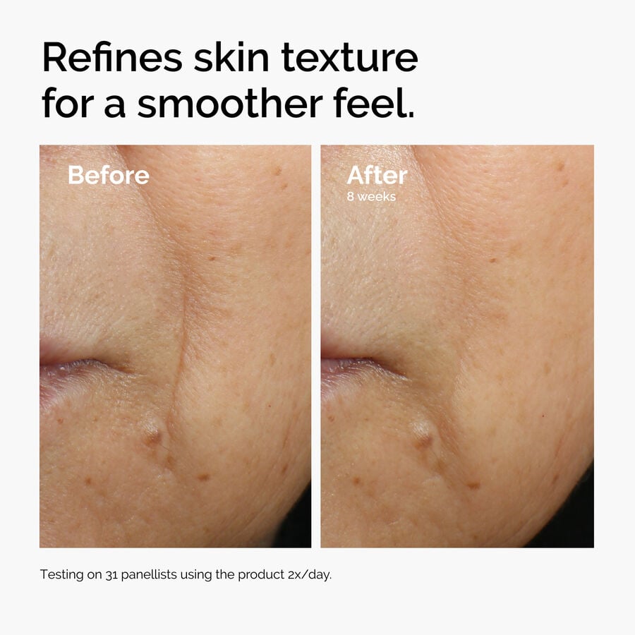 caffeine-3-escin-1-face-serum-y3 ord-caffeine-3pct-escin-1pct-face-serum-before-after-texture.jpg