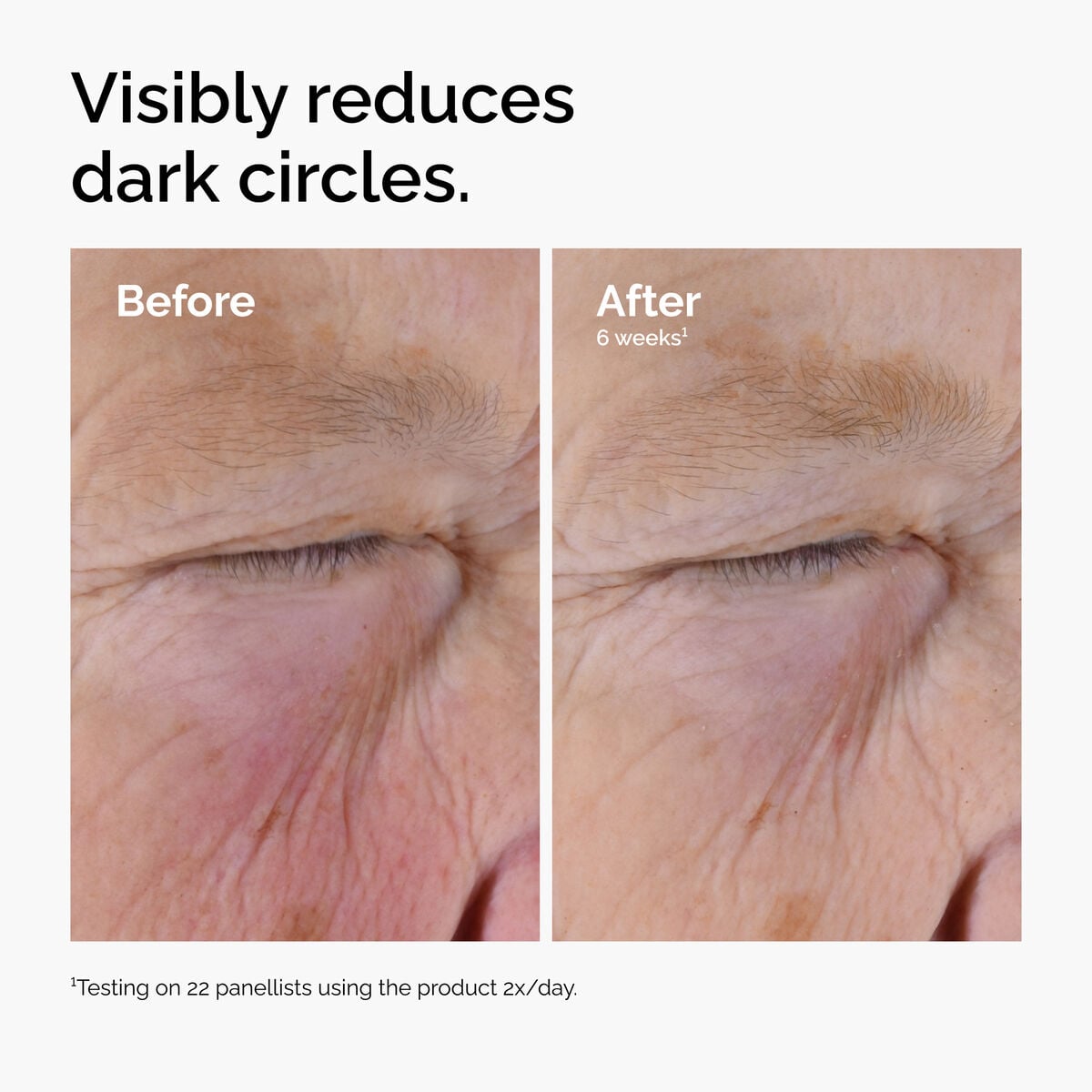 caffeine-solution-5-egcg-eye-serum-o3 ord-caffeine-solution-egcg-dark-circles-before-after.jpg