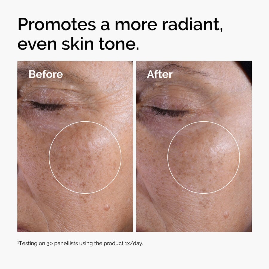 glycolic-acid-7-exfoliating-toner-l6 ord-glycolic-before-after-radiance.jpg
