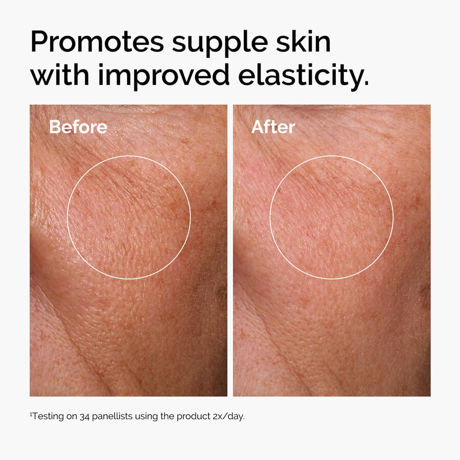 hyaluronic-acid-2-b5-with-ceramides-b1 ord-hyaluronic-acid-2pct-b5-hydrating-serum-before-after-elasticity.jpg