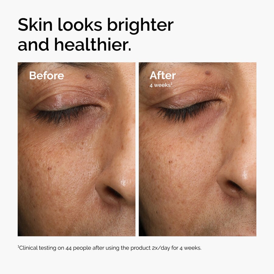 multi-antioxidant-radiance-serum-n7 ord-mars-before-after-healthy.jpg