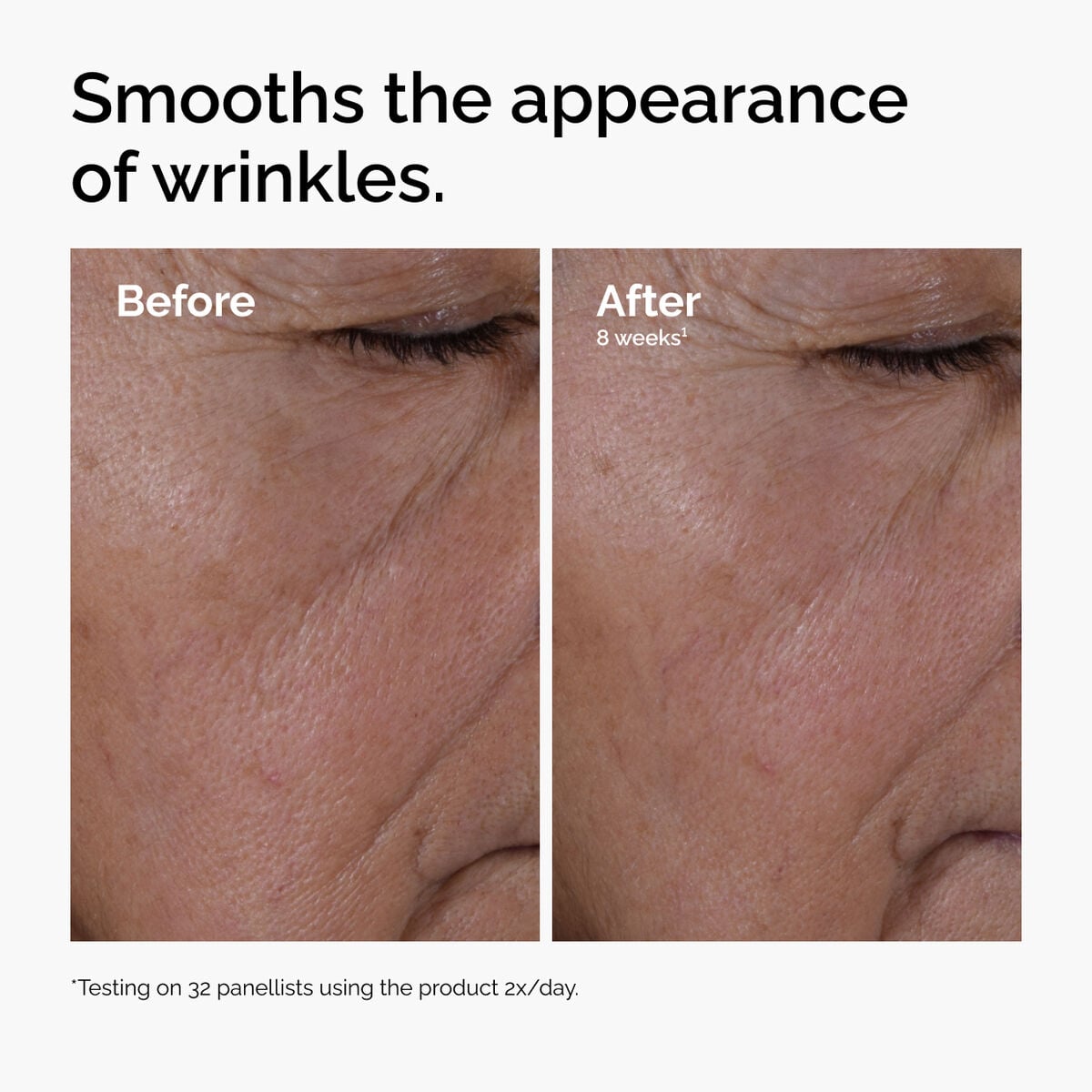 multi-peptide-ha-serum-f8 ord-multi-peptide-ha-serum-wrinkles-before-after.jpg