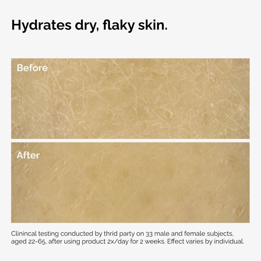 the-body-care-collection-v4 ord-natural-moisturizing-factors-inulin-body-before-after-graphic-02.jpg