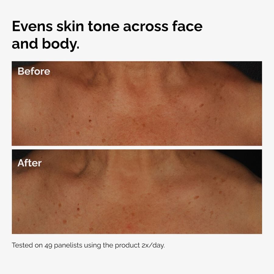 the-body-care-collection-v4 ord-niacinamide-face-body-serum-before-after-even-tone-graphic.jpg