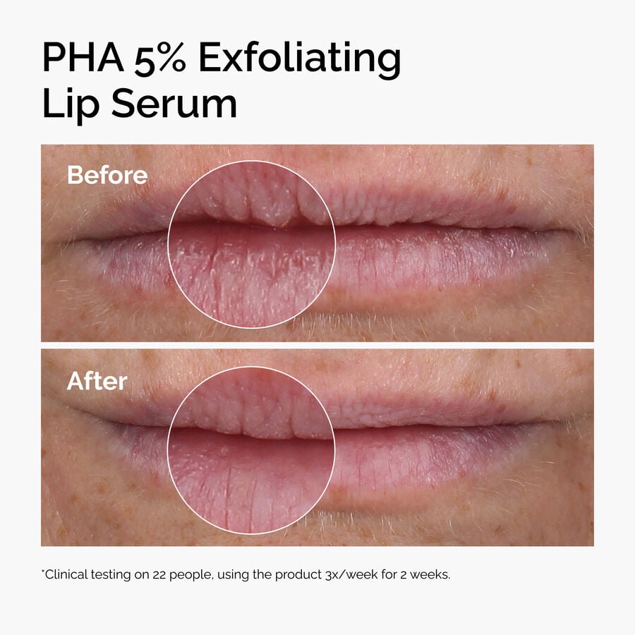pha-5-exfoliating-lip-serum-z6 ord-pha-5pct-lip-exfoliating-serum-before-after.jpg