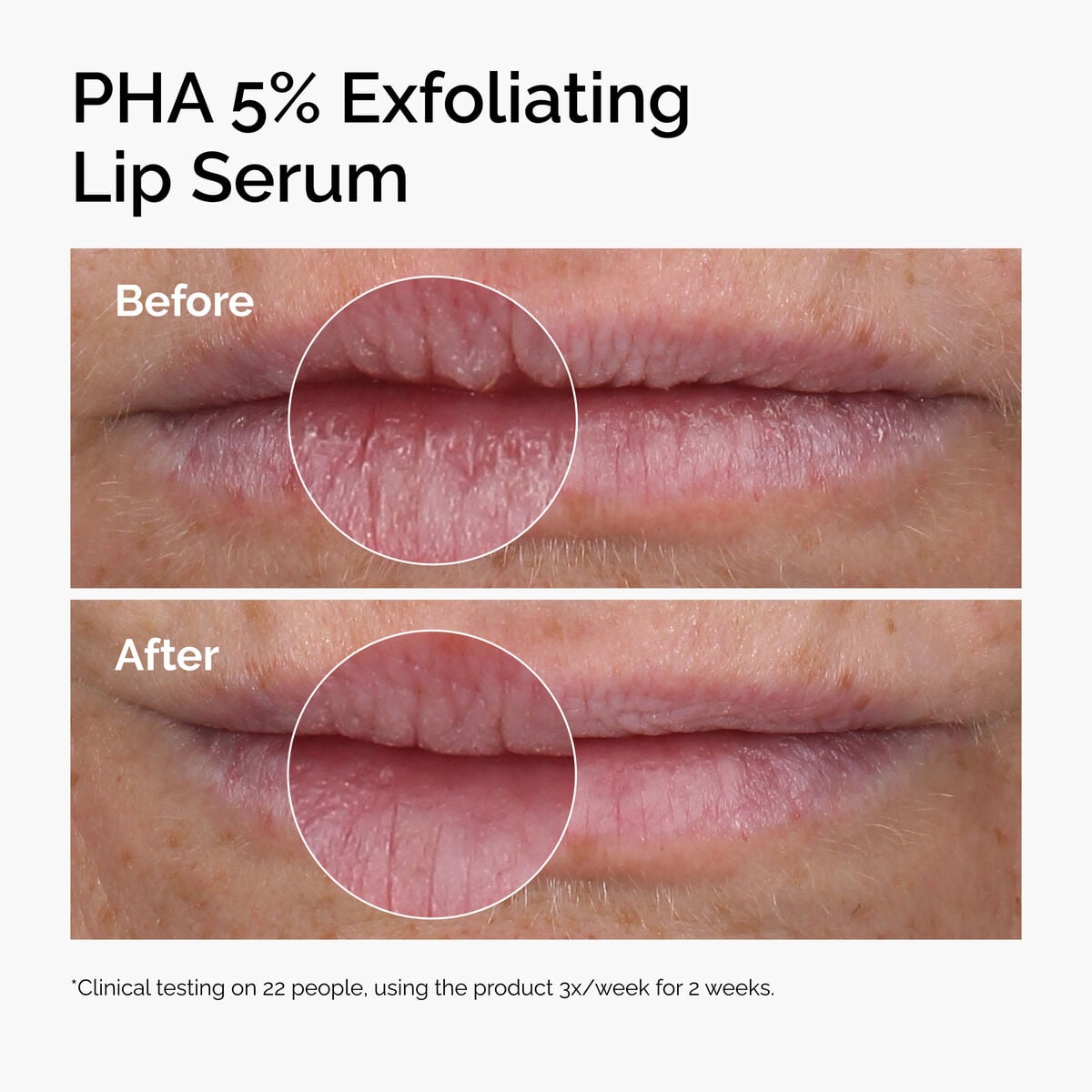 pha-5-exfoliating-lip-serum-z6 ord-pha-5pct-lip-exfoliating-serum-before-after.jpg