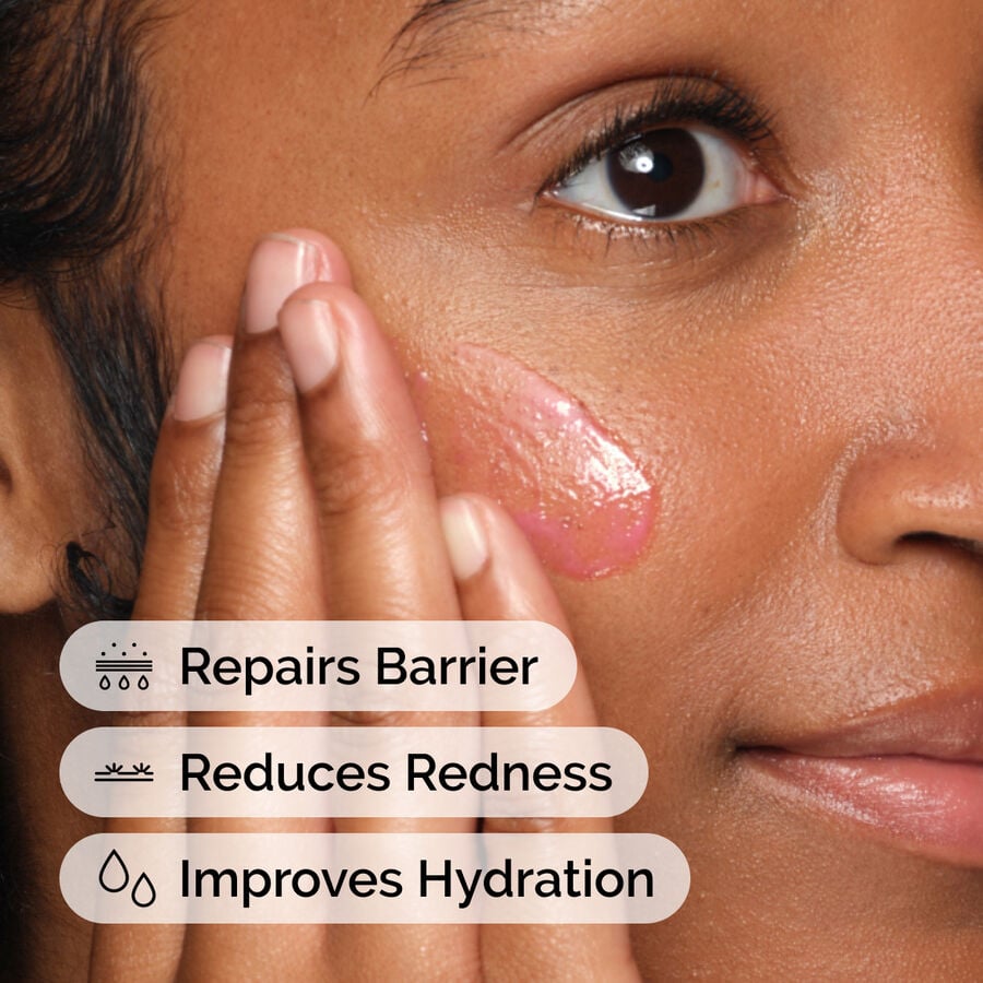 soothing-and-barrier-support-serum-set-b5 ord-soothing-barrier-support-serum-model-application-with-benefits.jpg