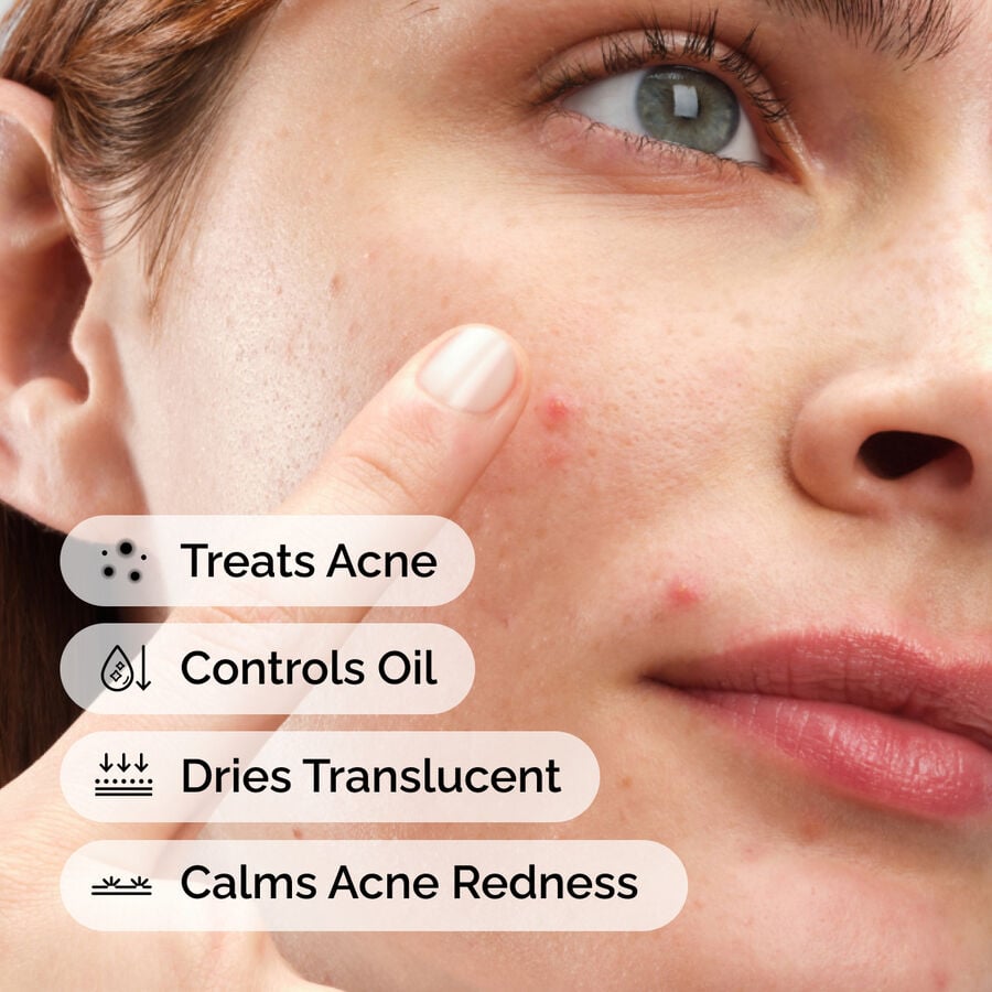 sulfur-10-powder-to-cream-concentrate-m3 ord-sulfur-10pct-powder-to-cream-concentrate-model-application-with-benefits-acne.jpg